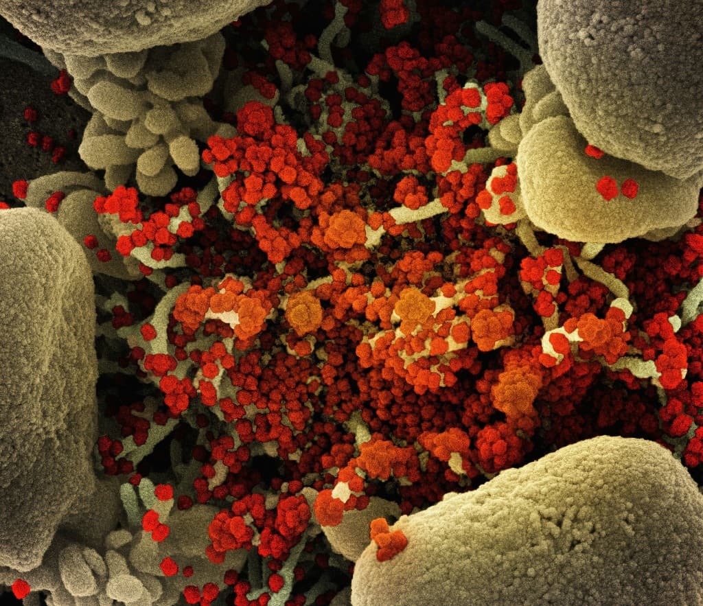 Colorized scanning electron micrograph of SARS-CoV-2 virus particles emerging from a cell surface