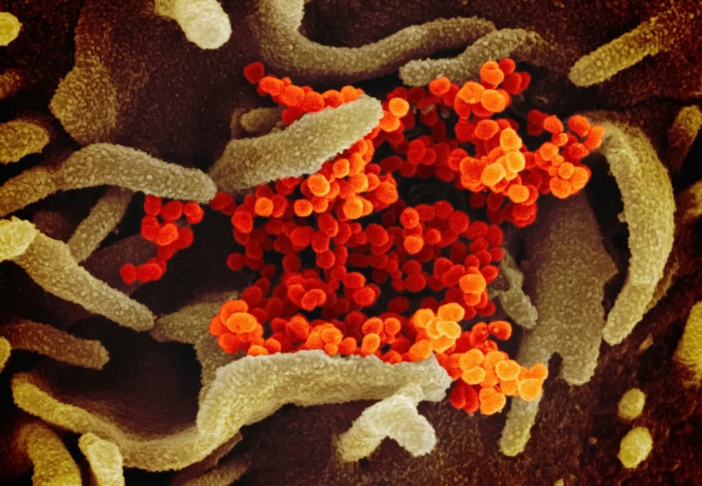 Colorized scanning electron micrograph of SARS-CoV-2 virus particles emerging from a cell surface